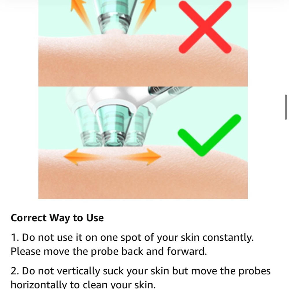 Blackhead Remover Pore Vacuum Removal Tool - Picture 9 of 12